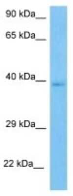 Western Blot: C5L2/GPR77 Antibody [NBP3-10864] - Western blot analysis of C5L2/GPR77 in Human 786-0 Whole Cell lysates. Antibody dilution at 1ug/ml