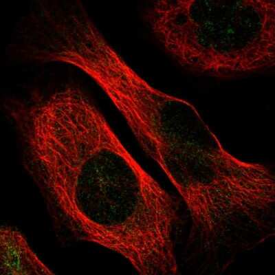 Immunocytochemistry/Immunofluorescence: C5orf22 Antibody [NBP1-83769] - Immunofluorescent staining of human cell line U-2 OS shows localization to nuclear membrane.