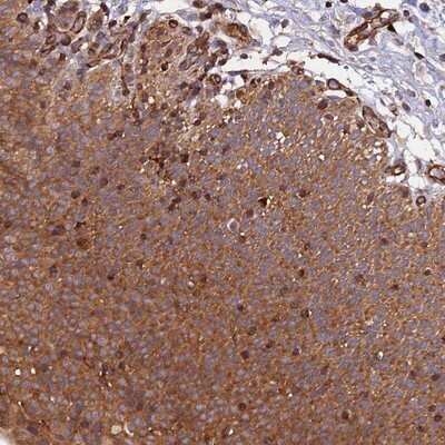 Immunohistochemistry-Paraffin: C5orf22 Antibody [NBP1-83769] - Staining of human urinary bladder shows moderate cytoplasmic positivity in urothelium.