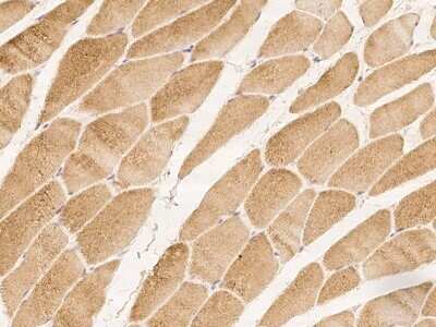 Immunohistochemistry-Paraffin: C5orf22 Antibody [NBP2-98180] - Immunochemical staining of human C5orf22 in human kidney with rabbit polyclonal antibody at 1:100 dilution, formalin-fixed paraffin embedded sections.