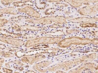 Immunohistochemistry-Paraffin: C5orf22 Antibody [NBP2-98180] - Immunochemical staining of human C5orf22 in human skeletal muscle with rabbit polyclonal antibody at 1:100 dilution, formalin-fixed paraffin embedded sections.