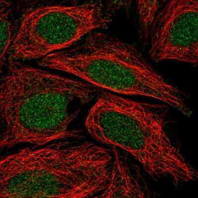 Immunocytochemistry/Immunofluorescence: C5orf24 Antibody [NBP2-56350] - Staining of human cell line SiHa shows localization to nucleus.