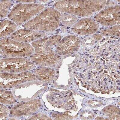 Immunohistochemistry-Paraffin: C5orf24 Antibody [NBP2-31686] - Staining of human kidney shows moderate cytoplasmic and nuclear positivity in renal tubules.