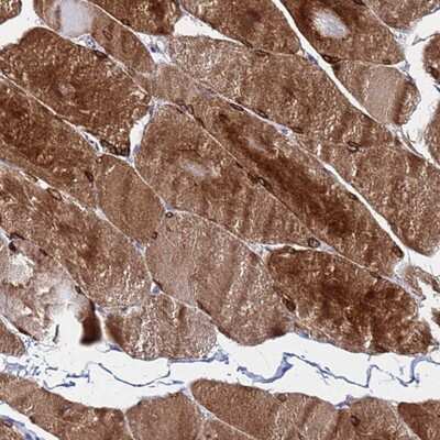 Immunohistochemistry-Paraffin: C5orf34 Antibody [NBP1-91735] Staining of human skeletal muscle shows strong cytoplasmic positivity in myocytes.