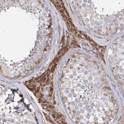 Immunohistochemistry-Paraffin C5orf36 Antibody - BSA Free
