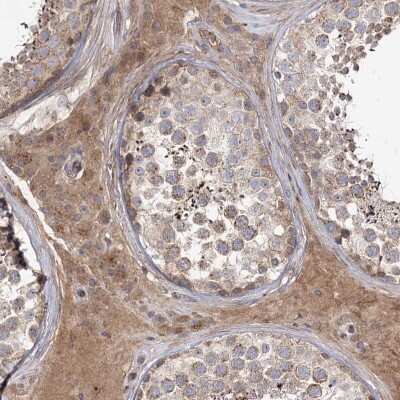 Immunohistochemistry-Paraffin C5orf36 Antibody - BSA Free