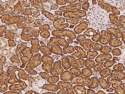 Immunohistochemistry-Paraffin: C5orf36 Antibody [NBP3-06008] - Immunochemical staining of human KIAA0825 in human kidney with rabbit polyclonal antibody at 1:100 dilution, formalin-fixed paraffin embedded sections.