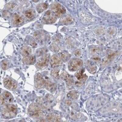 Immunohistochemistry-Paraffin: C5orf46 Antibody [NBP3-17154] - Staining of human salivary gland shows moderate cytoplasmic positivity in glandular cells.