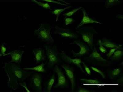 Immunocytochemistry/Immunofluorescence: C5orf51 Antibody [H00285636-B01P] - Analysis of purified antibody to C5orf51 on HeLa cell. (antibody concentration 10 ug/ml)