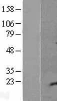Western Blot: C5orf53 Overexpression Lysate (Adult Normal) [NBL1-12612] Left-Empty vector transfected control cell lysate (HEK293 cell lysate); Right -Over-expression Lysate for C5orf53.