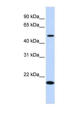 Western Blot: C5orf55 Antibody [NBP1-70474] - Titration: 0.2-1 ug/ml, Positive Control: Human Liver.