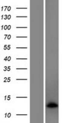 Western Blot: C5orf55 Overexpression Lysate (Adult Normal) [NBP2-05651] Left-Empty vector transfected control cell lysate (HEK293 cell lysate); Right -Over-expression Lysate for C5orf55.