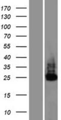 Western Blot: C6orf106 Overexpression Lysate (Adult Normal) [NBP2-06411] Left-Empty vector transfected control cell lysate (HEK293 cell lysate); Right -Over-expression Lysate for C6orf106.