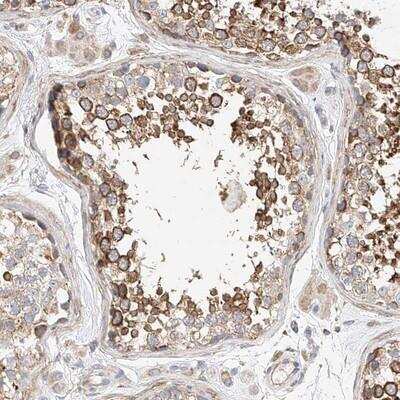 Immunohistochemistry: C6orf118 Antibody [NBP1-88727] - Staining of human testis shows strong cytoplasmic positivity in subsets of seminiferus duct cells.