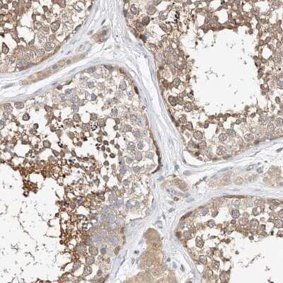 Immunohistochemistry-Paraffin: C6orf118 Antibody [NBP1-88726] - Staining of human testis shows moderate cytoplasmic positivity in seminiferous ducts.