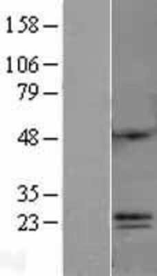 Western Blot: C6orf120 Overexpression Lysate (Adult Normal) [NBL1-08510] Left-Empty vector transfected control cell lysate (HEK293 cell lysate); Right -Over-expression Lysate for C6orf120.