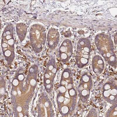 Immunohistochemistry-Paraffin: C6orf136 Antibody [NBP2-14419] - Staining of human gastrointestinal shows strong cytoplasmic positivity in glandular cells.