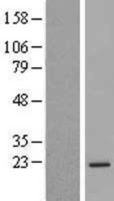 Western Blot: C6orf136 Overexpression Lysate (Adult Normal) [NBL1-08515] Left-Empty vector transfected control cell lysate (HEK293 cell lysate); Right -Over-expression Lysate for C6orf136.