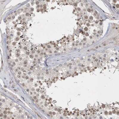 Immunohistochemistry-Paraffin: C6orf146 Antibody [NBP1-93471] - Staining of human testis shows moderate nuclear positivity in seminiferous duct cells.