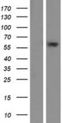 Western Blot: C6orf146 Overexpression Lysate (Adult Normal) [NBP2-05118] Left-Empty vector transfected control cell lysate (HEK293 cell lysate); Right -Over-expression Lysate for C6orf146.