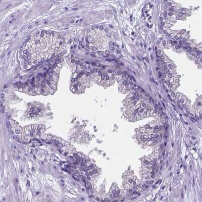 Immunohistochemistry-Paraffin: C6orf154 Antibody [NBP1-91736] - Staining of human prostate shows low expression as expected.
