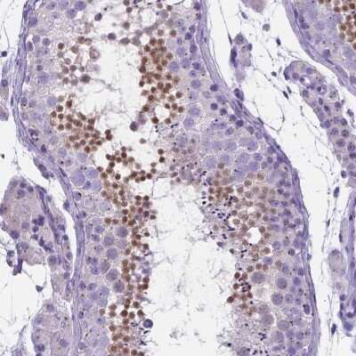 Immunohistochemistry-Paraffin: C6orf154 Antibody [NBP1-91736] - Staining of human testis shows high expression.