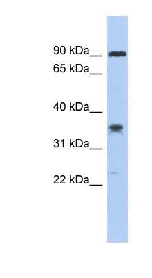 Western Blot: C6orf154 Antibody [NBP1-56949] - COLO205 cells lysate, concentration 0.2-1 ug/ml.