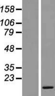 Western Blot: C6orf162 Overexpression Lysate (Adult Normal) [NBP2-09234] Left-Empty vector transfected control cell lysate (HEK293 cell lysate); Right -Over-expression Lysate for C6orf162.