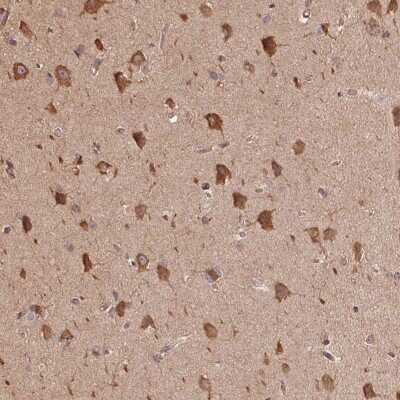Immunohistochemistry: C6orf163 Antibody [NBP2-49066] - Staining of human cerebral cortex shows strong cytoplasmic positivity in neuronal cells.