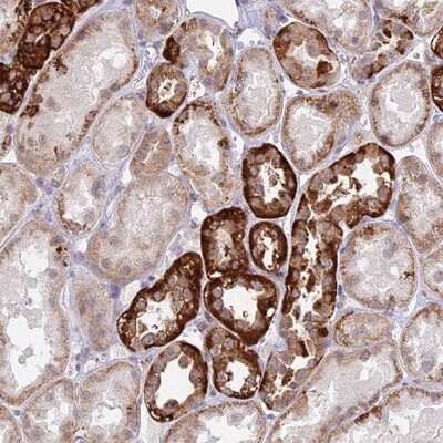 Immunohistochemistry-Paraffin: C6orf163 Antibody [NBP1-94165] - Staining of human kidney shows strong cytoplasmic positivity in - cells in tubules.