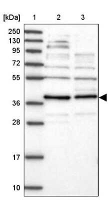 Western Blot: FAXC Antibody [NBP1-90579] - Lane 1: Marker  [kDa] 250, 130, 95, 72, 55, 36, 28, 17, 10.  Lane 2: Human cell line RT-4.  Lane 3: Human cell line U-251MG sp