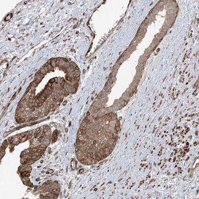 Immunohistochemistry-Paraffin: C6orf174 Antibody [NBP2-34001] - Immunohistochemical staining of human prostate shows distinct cytoplasmic, membranous and nuclear positivity in glandular cells.