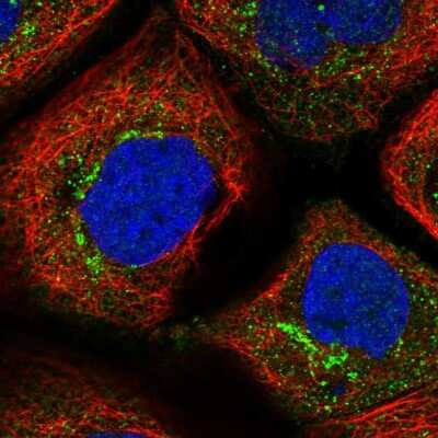 Immunocytochemistry/Immunofluorescence: C6orf192 Antibody [NBP1-85170] - Immunofluorescent staining of human cell line A-431 shows localization to cytosol & the Golgi apparatus.