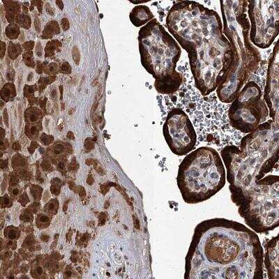 Immunohistochemistry-Paraffin: C6orf192 Antibody [NBP1-85170] - Staining of human placenta shows strong cytoplasmic and nuclear positivity in trophoblastic cells and decidua cells.