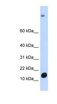 Western Blot: C6orf201 Antibody [NBP1-70476] - Human Muscle lysate, concentration 0.2-1 ug/ml.