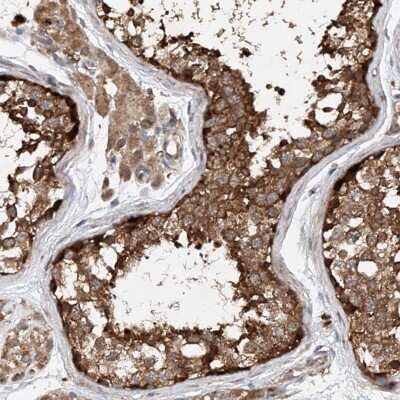 Immunohistochemistry-Paraffin CEP85L Antibody - BSA Free