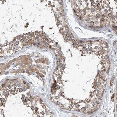 Immunohistochemistry-Paraffin CEP85L Antibody - BSA Free