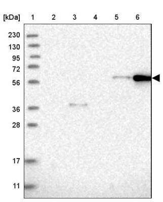 Western Blot CEP85L Antibody - BSA Free