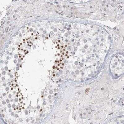 Immunohistochemistry-Paraffin C6orf222 Antibody - BSA Free