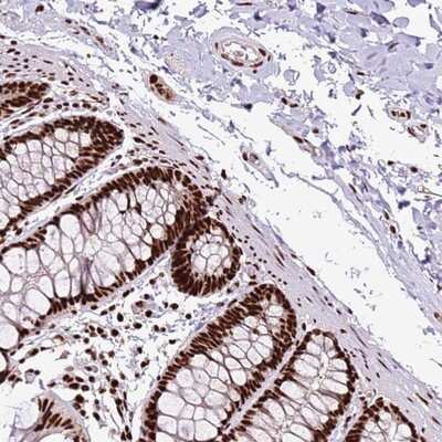 Immunohistochemistry-Paraffin: C6orf226 Antibody [NBP1-91739] - Staining of human colon shows strong nuclear positivity in glandular cells and ganglion.