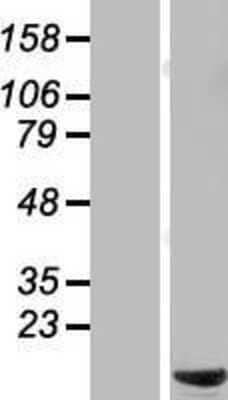 Western Blot: C6orf226 Overexpression Lysate (Adult Normal) [NBL1-12609] Left-Empty vector transfected control cell lysate (HEK293 cell lysate); Right -Over-expression Lysate for C6orf226.