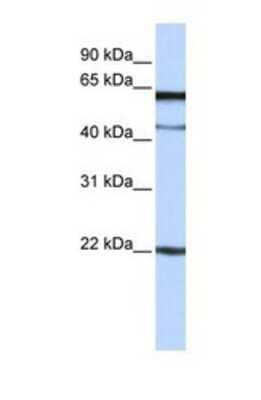Western Blot: C6orf25 Antibody [NBP1-69388] - This Anti-C6orf25 antibody was used in Western Blot of Jurkat tissue lysate at a concentration of 1ug/ml.