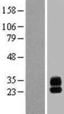 Western Blot G6b/C6orf25 Overexpression Lysate