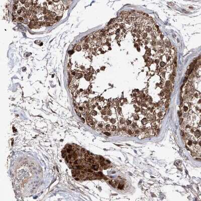 Immunohistochemistry-Paraffin: SDHAF4 Antibody [NBP1-86324] -  Staining of human testis shows moderate to strong cytoplasmic positivity in Leydig cells.