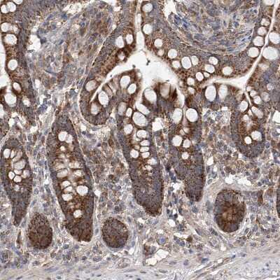 Immunohistochemistry-Paraffin: SDHAF4 Antibody [NBP1-86324] - Staining of human small intestine shows moderate to strong cytoplasmic positivity in glandular cells.