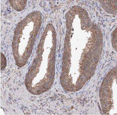 Immunohistochemistry-Paraffin: SDHAF4 Antibody [NBP1-86324] -  Staining of human prostate shows weak to moderate cytoplasmic positivity in glandular cells.