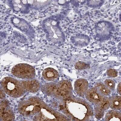 Immunohistochemistry-Paraffin: C6orf58 Antibody [NBP2-48738] - Staining of human duodenum shows strong cytoplasmic positivity in glandular cells in Brunner's glands.