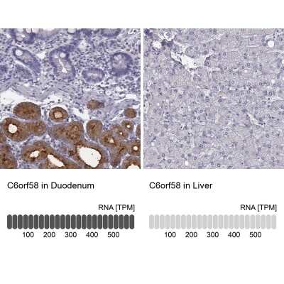 <b>Orthogonal Strategies Validation. </b>Immunohistochemistry-Paraffin: C6orf58 Antibody [NBP2-48738] - Staining in human duodenum and liver tissues using anti-C6orf58 antibody. Corresponding C6orf58 RNA-seq data are presented for the same tissues.