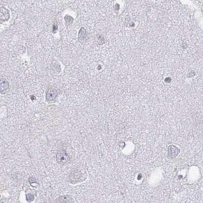 Immunohistochemistry-Paraffin: C6orf58 Antibody [NBP2-48738] - Staining of human cerebral cortex.