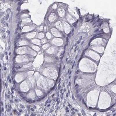 Immunohistochemistry-Paraffin C6orf58 Antibody - BSA Free